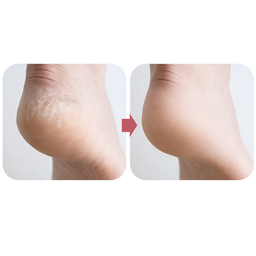Crystal pumice - foot grater 3D Soulima 25745